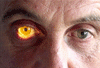 脊髄癆とアーガイル・ロバートソン瞳孔