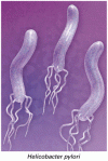 <i>Helicobacter pylori</i> 感染患者における上部消化管出血の再発予防