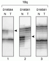 結腸癌化学療法後の生存に関する分子予測因子