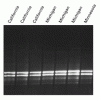 大腸菌（<i>Escherichia coli</i>）の多剤耐性クローンによる尿路感染症