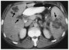 軍事研究細菌学者における鼻疽