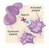 Clinical Practice：冠動脈疾患の一次予防のためのアスピリン