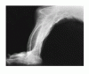 進行性骨異形成における <i>GNAS1</i> 遺伝子の不活性化突然変異