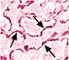 疾患のメカニズム：肺機能における疎水性サーファクタント蛋白と疾患