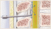 分娩・出産のための局所麻酔と無痛法