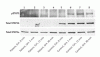 成長ホルモン不応性と <i>STAT5b</i> の突然変異