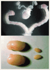 思春期の調節因子としての <i>GPR54 </i>遺伝子