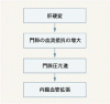 肝硬変と腹水の管理