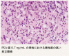 PSA 値が 4.0 ng/mL 以下の男性における前立腺癌の有病率