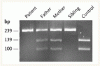 ミトコンドリア DNA の欠損と早期の致命的な肝性脳症