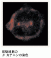 CML における白血病幹細胞の候補としての顆粒球マクロファージ前駆細胞