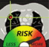 CT で発見された肺結節