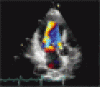 経胸壁心エコー画像