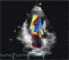経胸壁心エコー画像