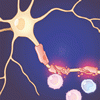 ミノサイクリンと多発性硬化症の発症