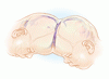 頭蓋結合双生児の分離