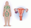 卵巣癌におけるリンパ節郭清と生存