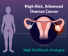 卵巣癌における無増悪生存期間を延長させる