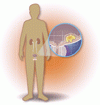 尿路上皮癌患者の生存期間を延長させる