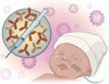 早産児における RS ウイルス感染を予防する