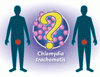 無症状の直腸クラミジアを治療する