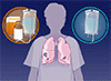 切除可能な肺癌に対するニボルマブベースの術前補助療法