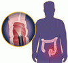 大腸癌に対する大腸内視鏡スクリーニング