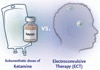 大うつ病に対するケタミンと ECT との比較