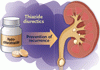 ヒドロクロロチアジドと腎結石の再発