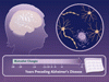 アルツハイマー病の診断に先行するバイオマーカー変化